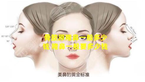骨胶原隆鼻一般多少钱 隆鼻一般要多少钱